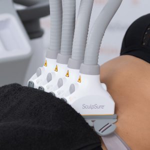 SculpSure: New No Downtime Laser Technology that Damages Fat Cells