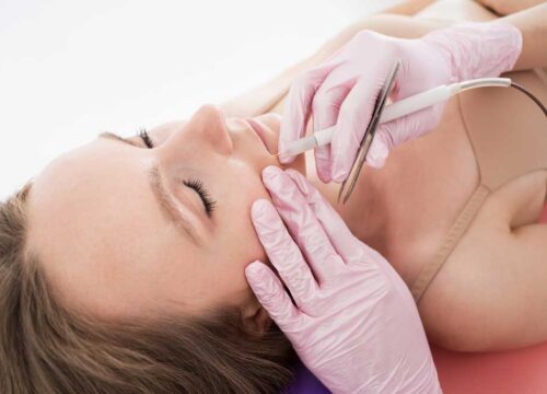 Electrolysis – Permanent Hair Removal