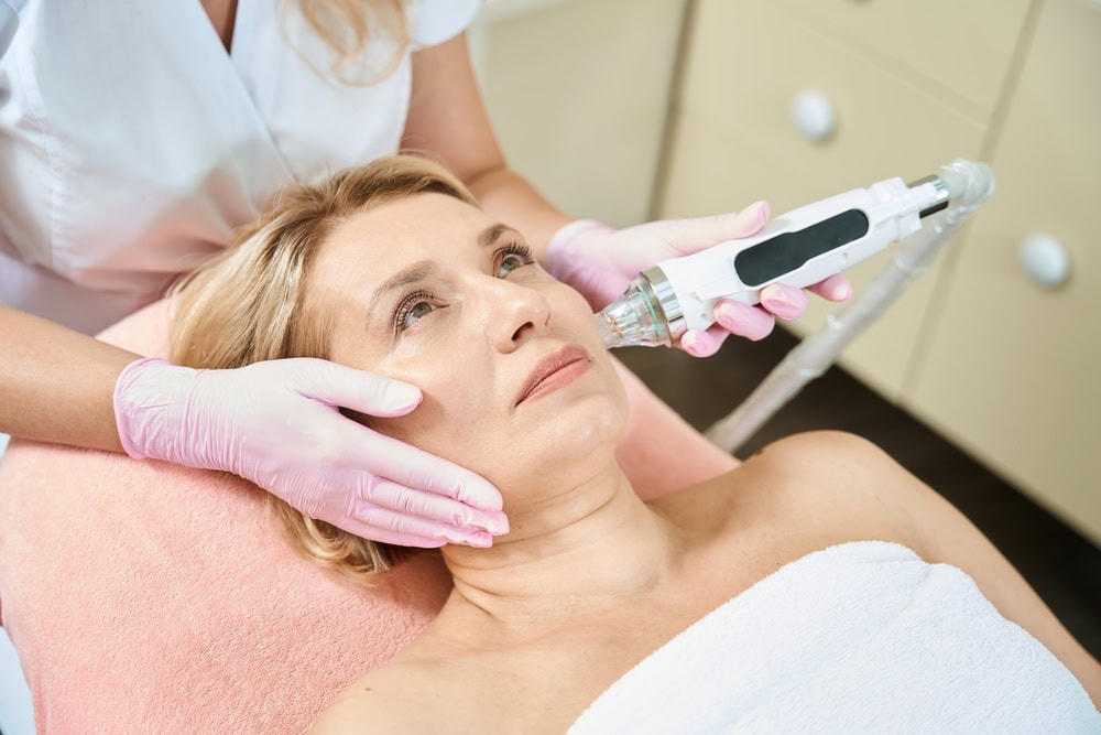 11 Impressive Benefits of Potenza™ RF Microneedling - Nouveau Medspas