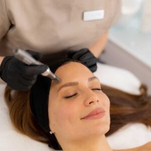 New Year, New You: Potenza™ RF Microneedling for Skin Renewal