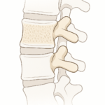 Why I’m Paying Closer Attention to Bone Health After 50